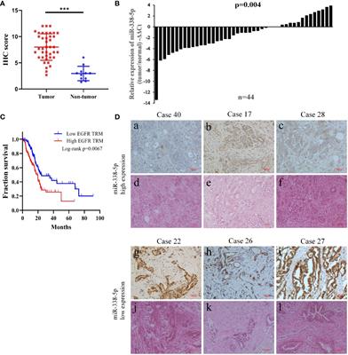 MiR-338-5p Inhibits EGF-Induced EMT in Pancreatic Cancer Cells by Targeting EGFR/ERK Signaling